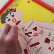 operation